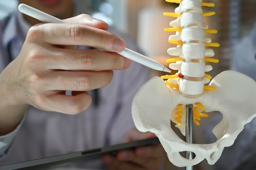 Image is of a doctor pointing to the spine on a learning skeleton concept of spinal disc injury treatment in Chicago