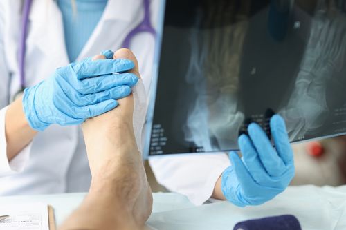 Image is of a doctor examining a patient's foot and an x-ray of that foot concept of Schererville injury treatment center